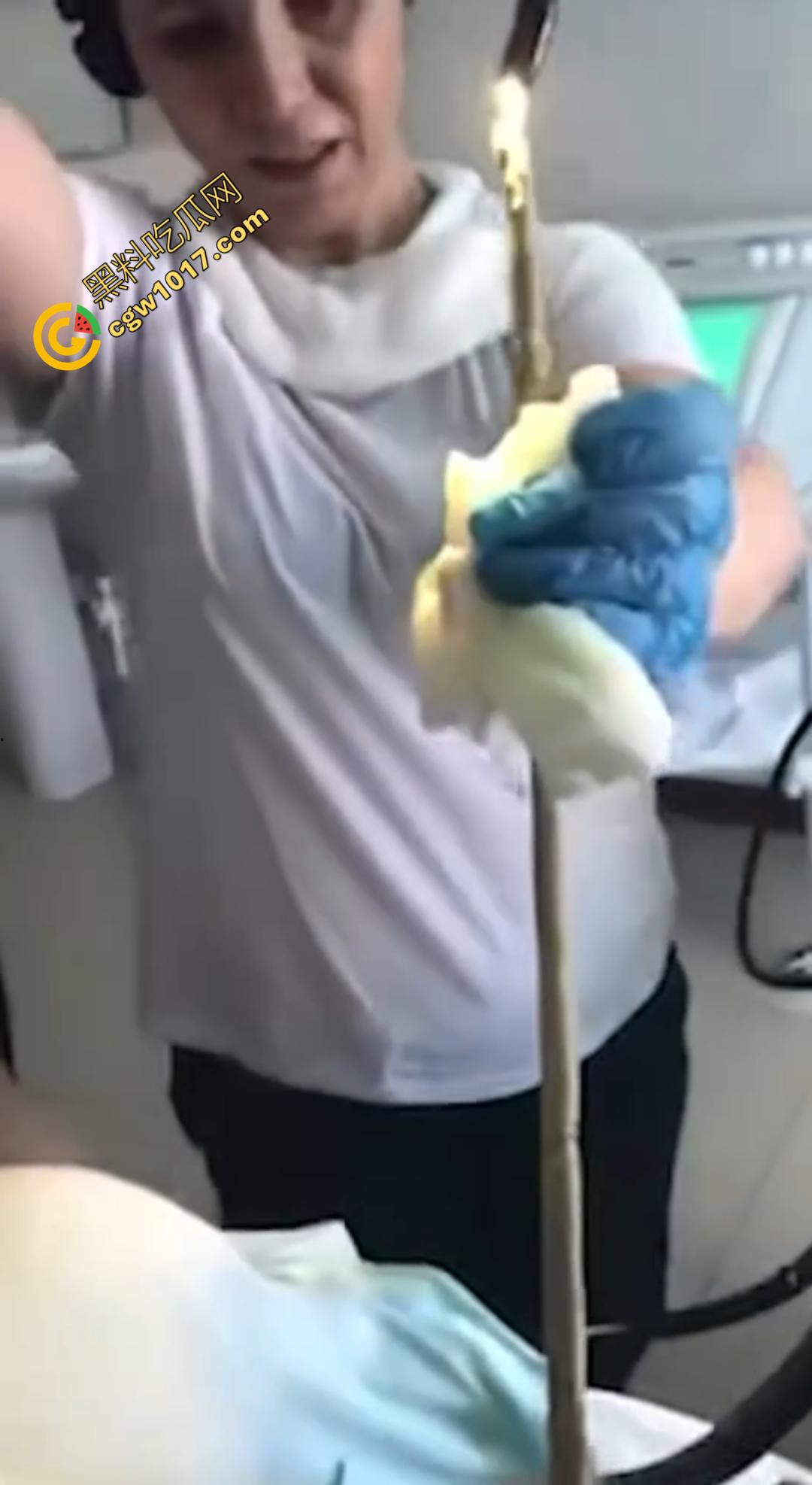 俄罗斯医院活拽1米毒蛇！女患者吞蛇卵孵化钻喉，医生手抖拽出瞬间到处乱窜！  第3张