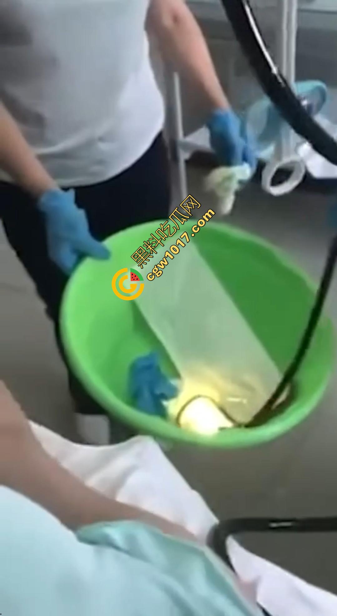 俄罗斯医院活拽1米毒蛇！女患者吞蛇卵孵化钻喉，医生手抖拽出瞬间到处乱窜！  第6张