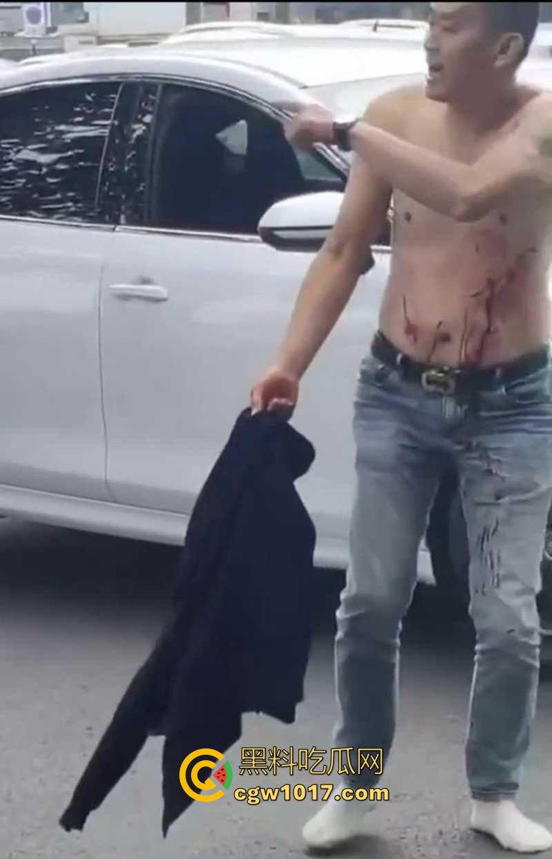 路怒症吵架秒变杀人现场！拔刀猛捅对面司机腹部，鲜血狂喷只能捂着肚子赶紧逃命！  第7张