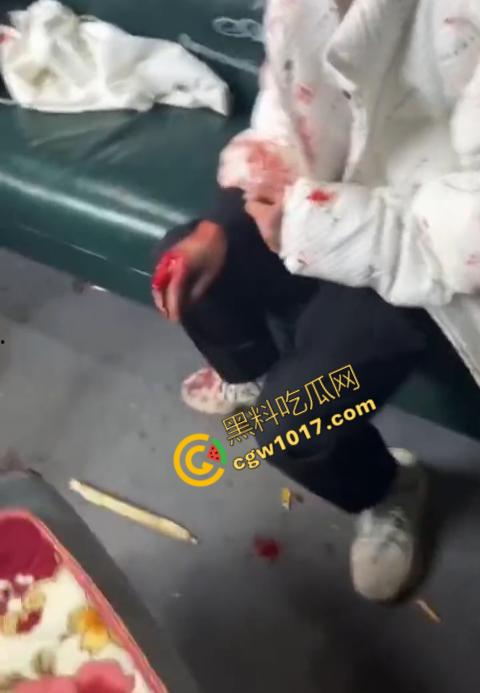 血腥慎点！社会混混残忍虐打小伙，马桶刷戳脸，铁管刺手，手背戳破血肉模糊，骨头暴露，惨不忍睹，令人心寒！  第8张