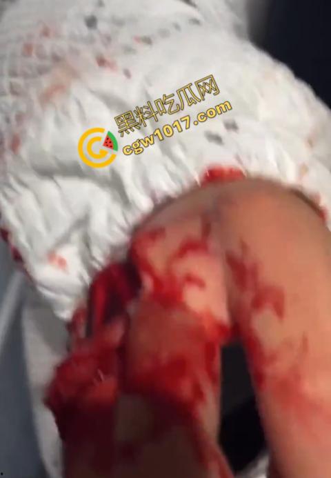 血腥慎点！社会混混残忍虐打小伙，马桶刷戳脸，铁管刺手，手背戳破血肉模糊，骨头暴露，惨不忍睹，令人心寒！  第9张