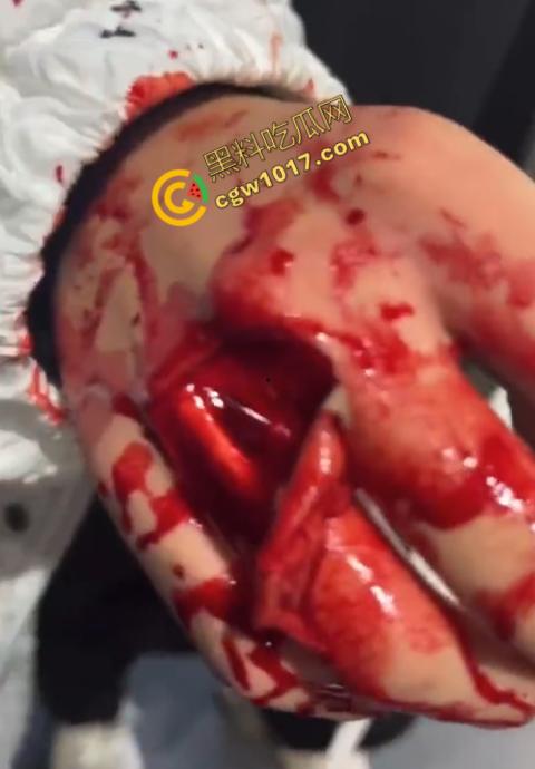 血腥慎点！社会混混残忍虐打小伙，马桶刷戳脸，铁管刺手，手背戳破血肉模糊，骨头暴露，惨不忍睹，令人心寒！  第10张