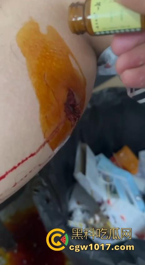 妙瓦底顺达园区缅甸KUN武装屠杀中国人！抢劫、轮奸、枪杀地盘之争，诈骗人员沦落为牺牲品，这时候你是中国人啦！  第9张