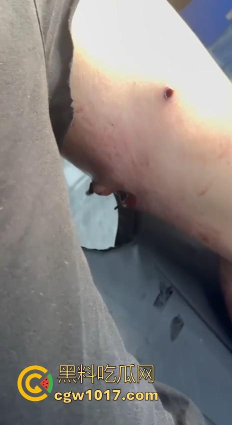 妙瓦底顺达园区缅甸KUN武装屠杀中国人！抢劫、轮奸、枪杀地盘之争，诈骗人员沦落为牺牲品，这时候你是中国人啦！  第10张