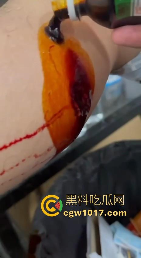 妙瓦底顺达园区缅甸KUN武装屠杀中国人！抢劫、轮奸、枪杀地盘之争，诈骗人员沦落为牺牲品，这时候你是中国人啦！  第11张