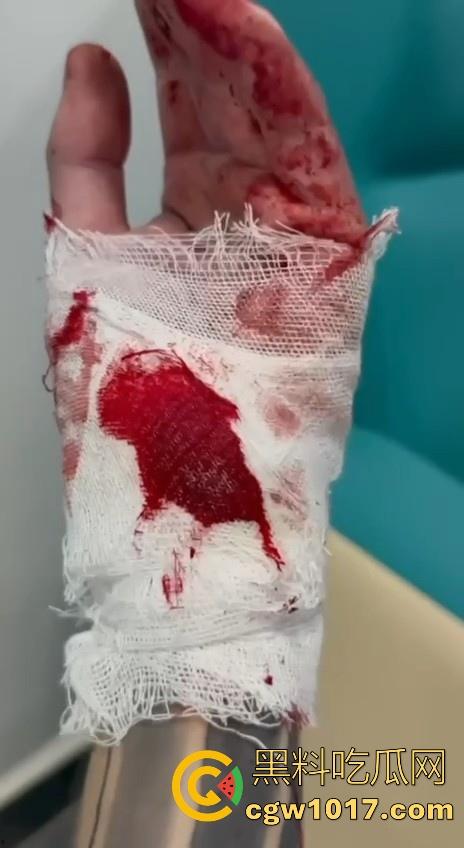 妙瓦底顺达园区缅甸KUN武装屠杀中国人！抢劫、轮奸、枪杀地盘之争，诈骗人员沦落为牺牲品，这时候你是中国人啦！  第14张