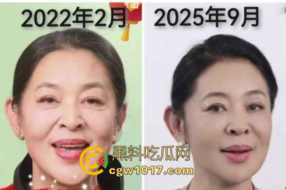 你见过心脏移植的明星吗？【李连杰】等众多大咖器官移植，换心换血黑科技年轻20岁，难道真有这种永生秘方？  第4张