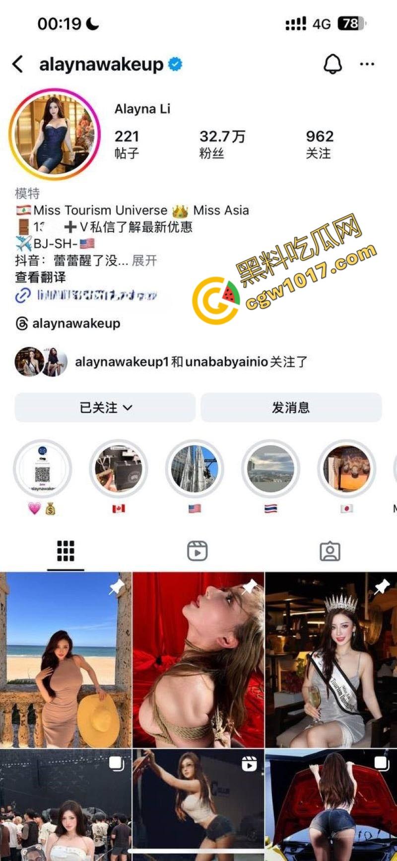 抖音极品尤物【蕾蕾醒了没】惊爆丑闻！秀人模特大赛冠军，竟下海卖淫5000一炮，不雅视频流出粉丝爆炸！  第1张