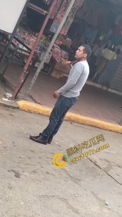 国外男子竟当街自残，刀割喉咙鲜血四溅，群众惊恐围观，男子倒地不省人事，惨烈一幕令人心悸胆战！  第6张