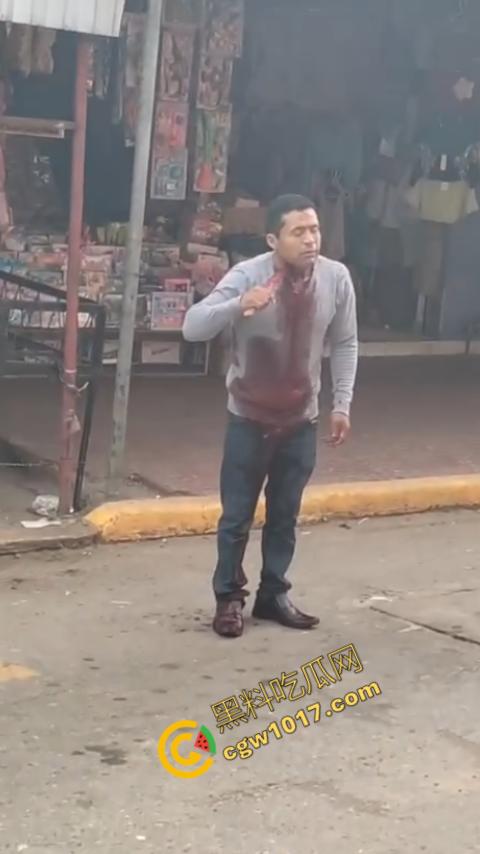 国外男子竟当街自残，刀割喉咙鲜血四溅，群众惊恐围观，男子倒地不省人事，惨烈一幕令人心悸胆战！  第8张