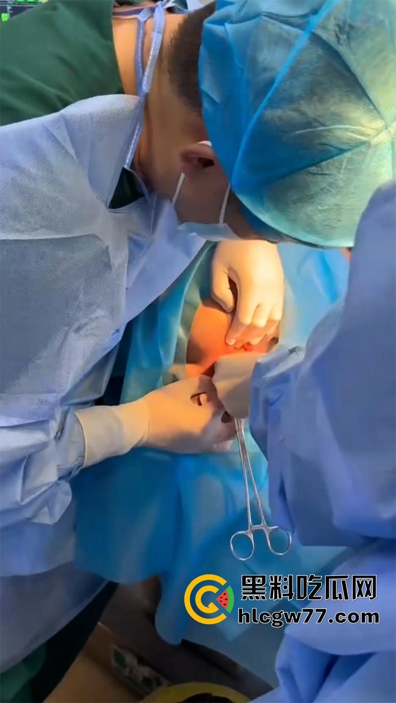 成都肛肠科又来新活，巨屌玩具塞入菊花拔不出来，只能到医院取出，这么大怎么塞进去的呢？  第2张