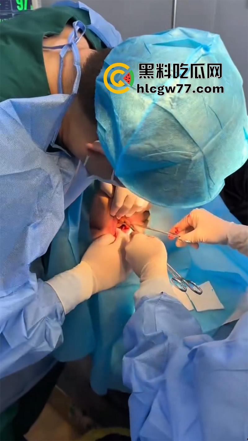 成都肛肠科又来新活，巨屌玩具塞入菊花拔不出来，只能到医院取出，这么大怎么塞进去的呢？  第3张