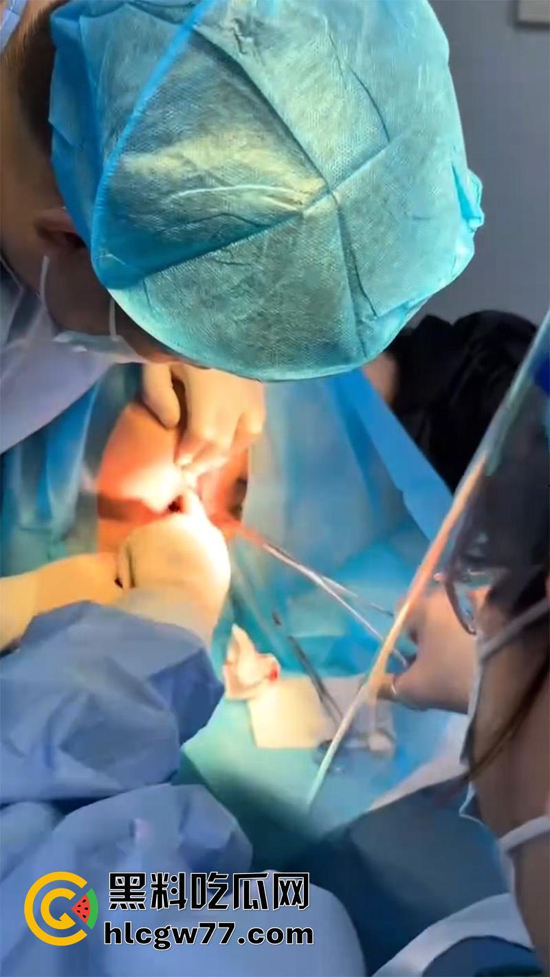 成都肛肠科又来新活，巨屌玩具塞入菊花拔不出来，只能到医院取出，这么大怎么塞进去的呢？  第4张