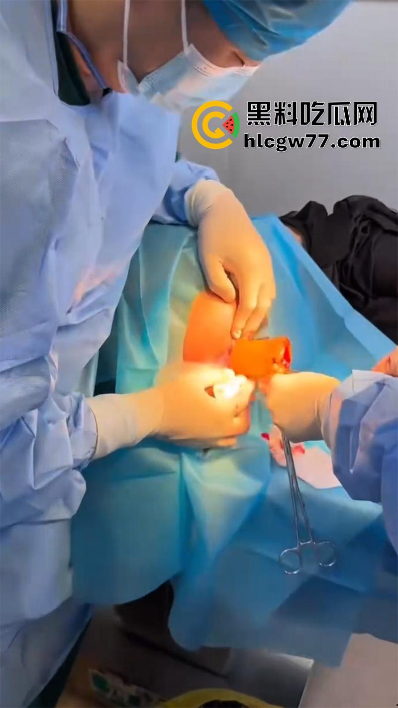 成都肛肠科又来新活，巨屌玩具塞入菊花拔不出来，只能到医院取出，这么大怎么塞进去的呢？  第6张