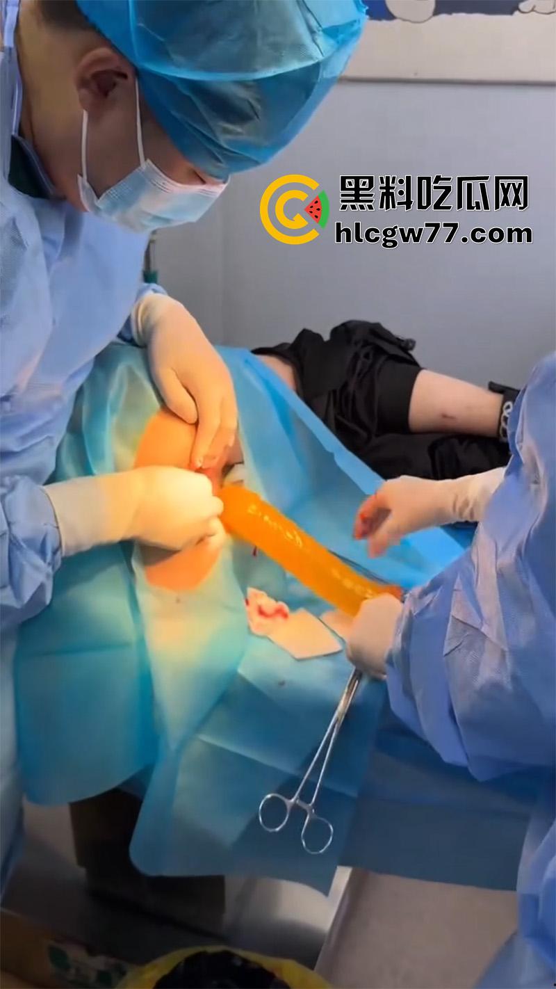 成都肛肠科又来新活，巨屌玩具塞入菊花拔不出来，只能到医院取出，这么大怎么塞进去的呢？  第8张