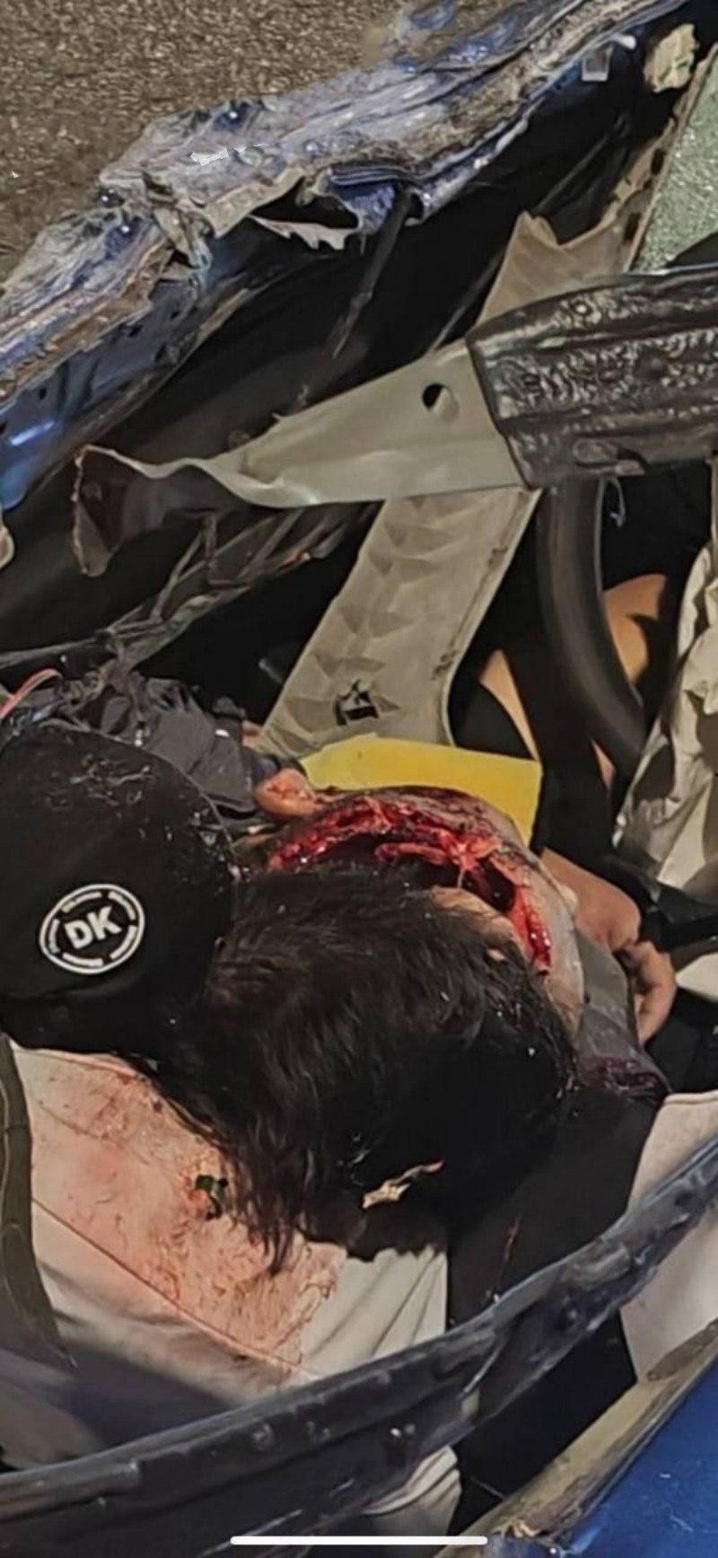 惨烈飞车爆脑！贵阳小米su7车主半夜上演激情狂飙，操作失误撞车造成1人当场死亡，现场惨烈恐怖  第5张