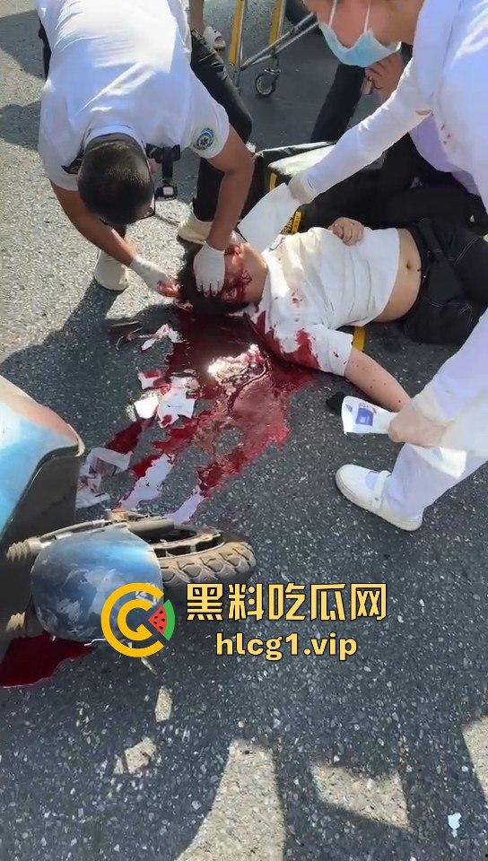 外卖小哥摩托车撞倒女子，女子头破血流浑身抽搐！  第1张