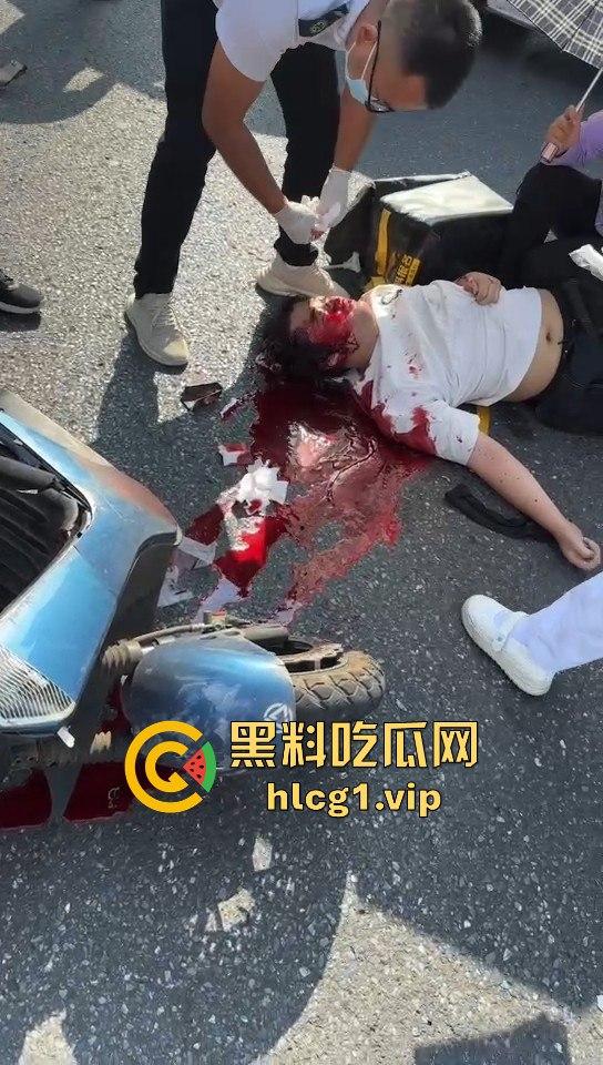 外卖小哥摩托车撞倒女子，女子头破血流浑身抽搐！  第8张