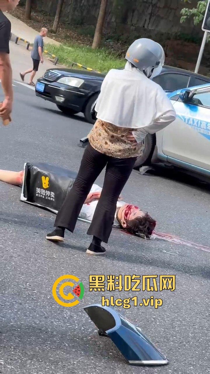 外卖小哥摩托车撞倒女子，女子头破血流浑身抽搐！  第9张