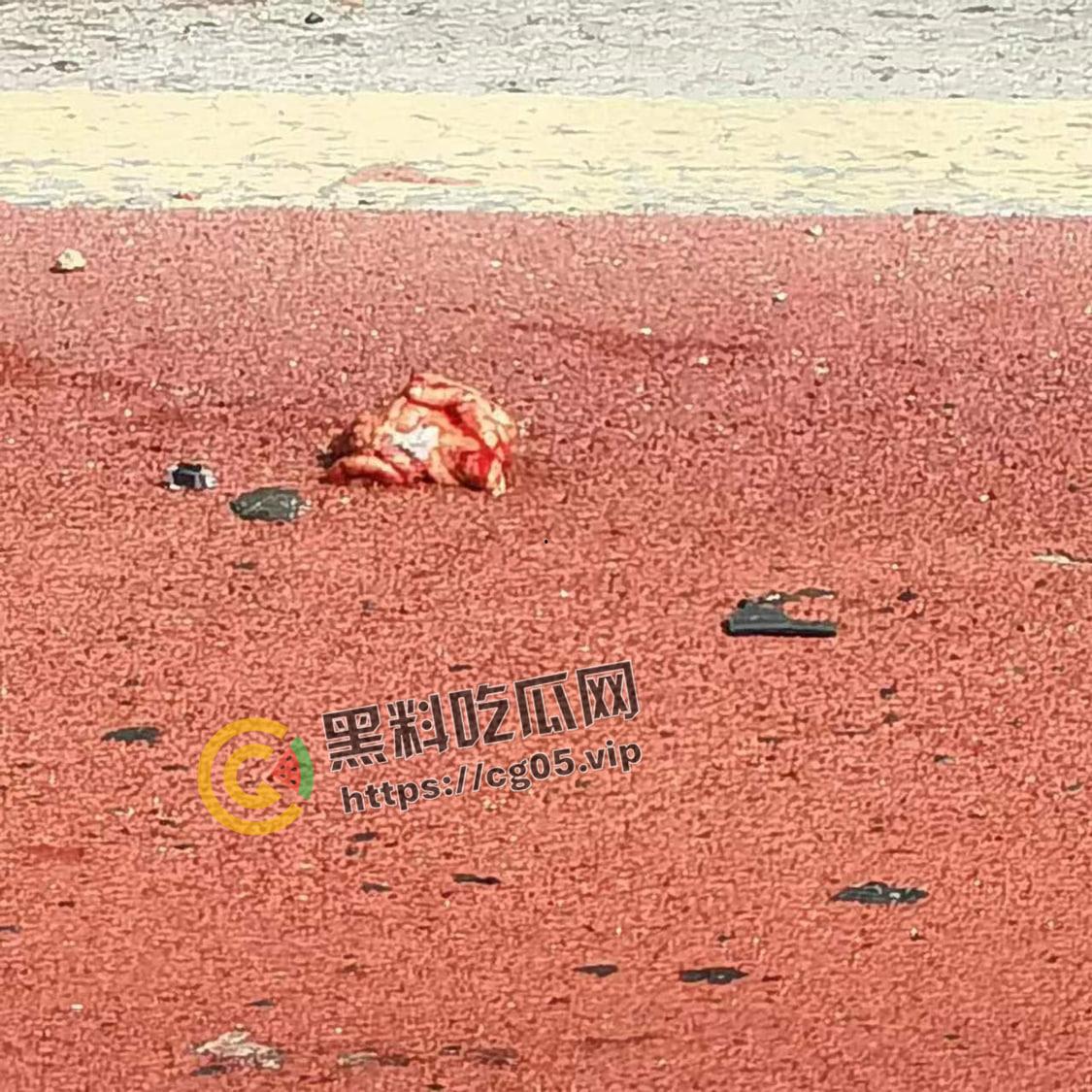 浙江极氪001撞死横穿马路路人 人头分离 整个脑浆撞出来了 现场血腥画面报告  第4张