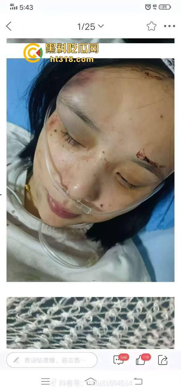 四川江油霸凌事件！持着母亲是公安局副局长就随便霸凌残疾人的孩子？还诱导其父签谅解书，激起民愤！  第13张