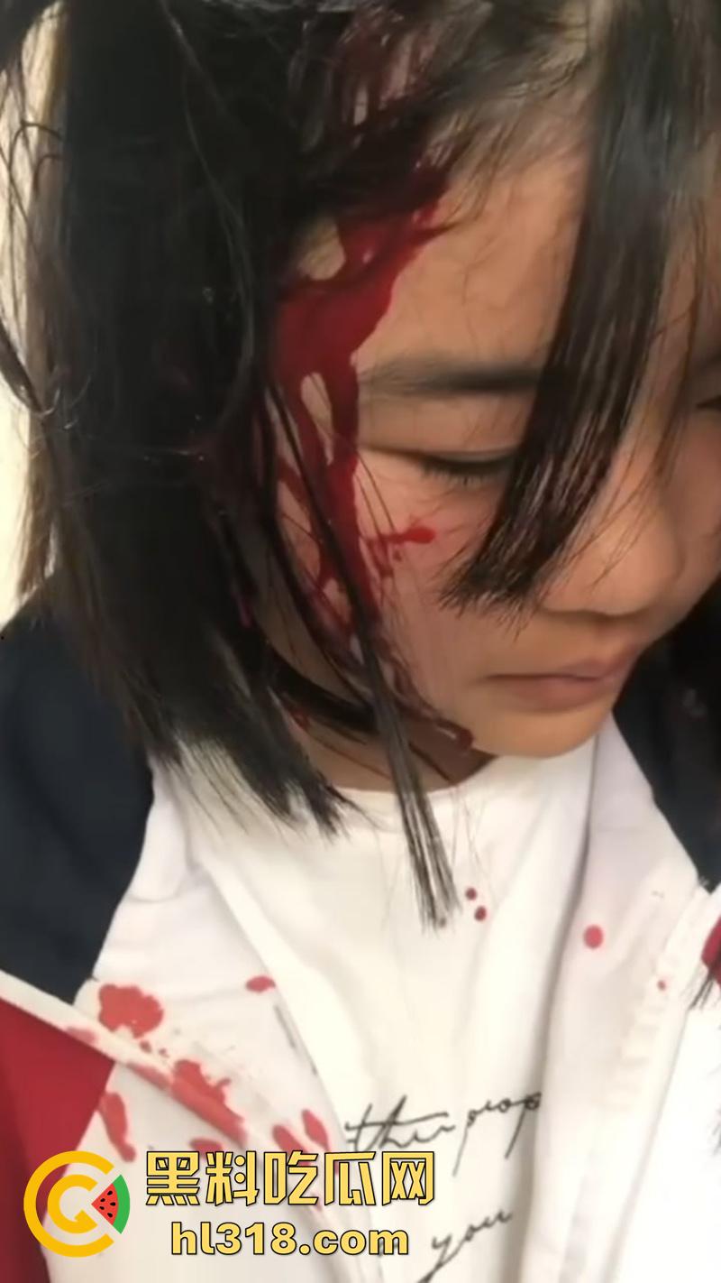 湖北第十一中学霸凌现场，实拍女学生被棍子爆头，果然最毒妇人心，欺负女人最狠的还得是女人  第7张