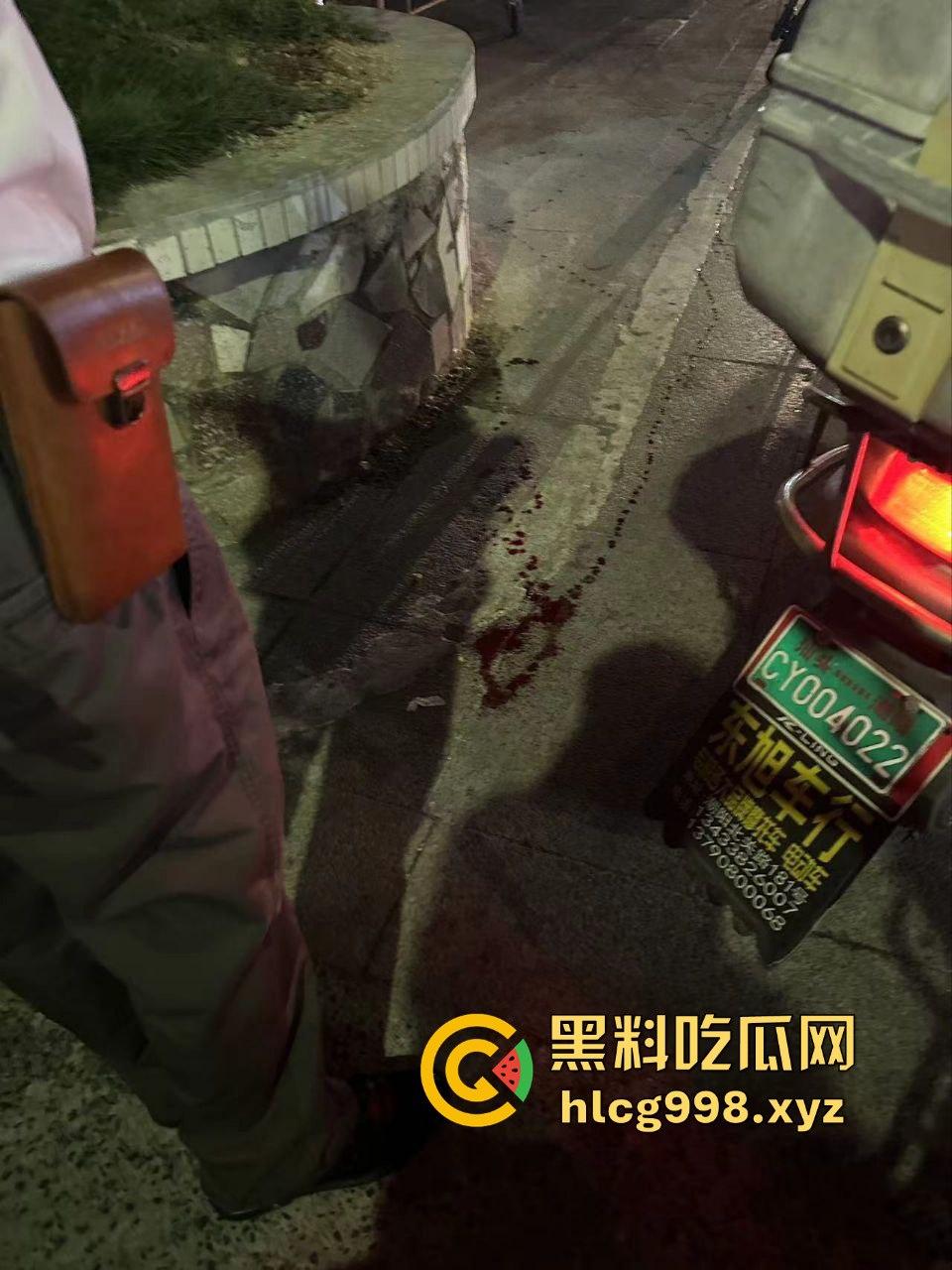 潮阳棉城精神小伙街头斗殴！马刀上手，砍到手臂当场飞掉！  第8张