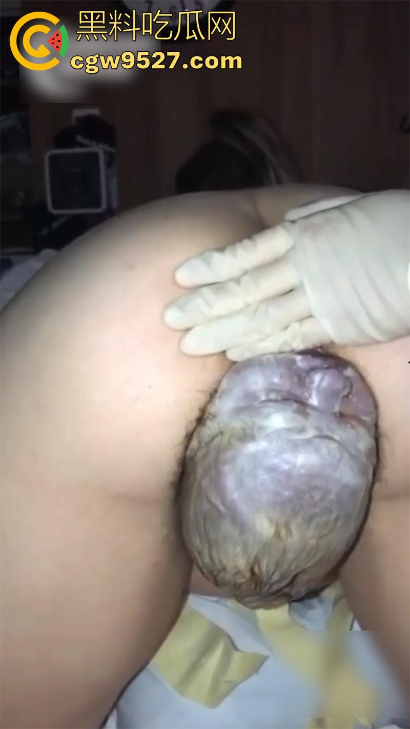 孕妇接生现场画面，体验生孩子的全过程，幸亏是个大肥逼，不然一定痛死了，原来大家都是这么来的啊！  第4张