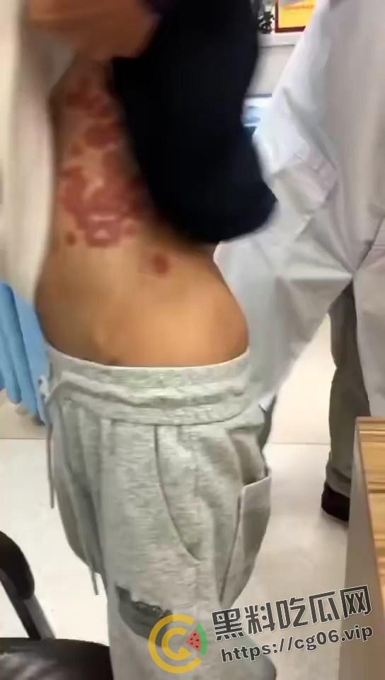 初三学生化身毒王 梅毒三期 艾滋 浑身腐烂 牛子流脓 还说自己没有过性生活 检查现场视频曝光  第1张