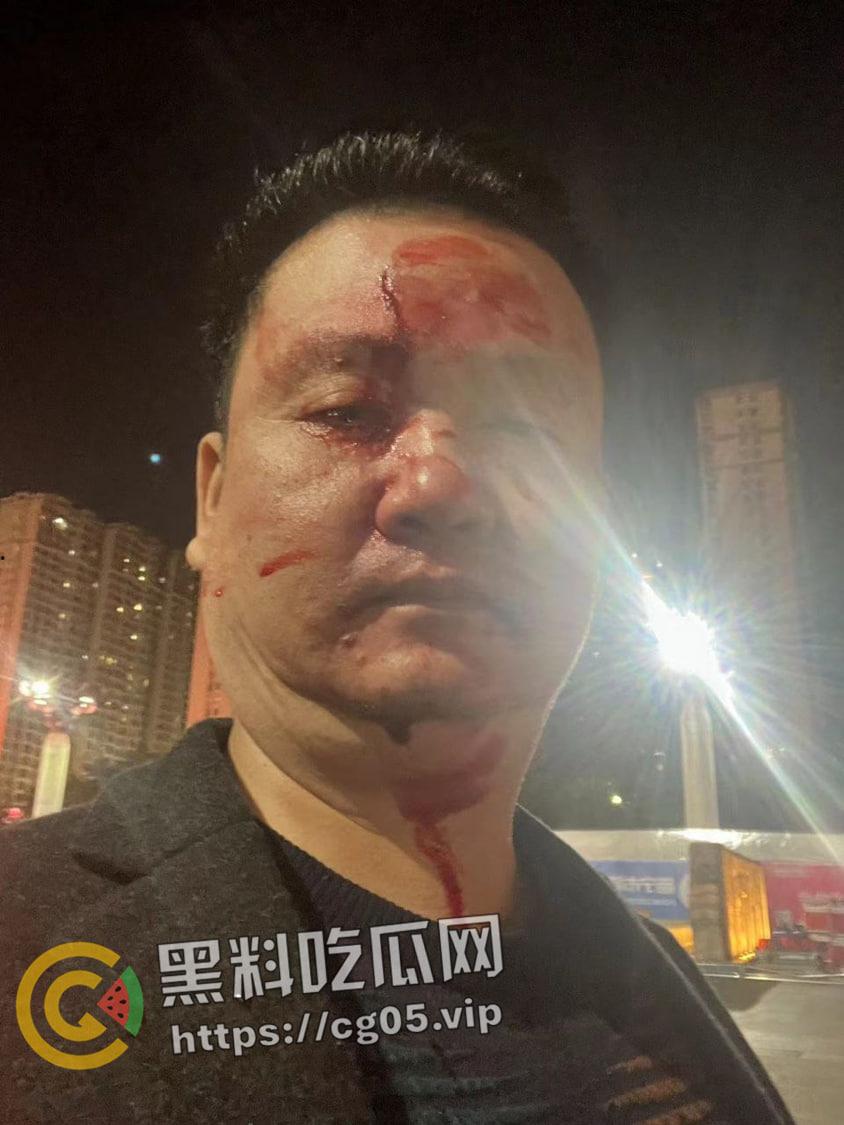 群友约架 不打你不是吴林风！广东普宁池尾两老登【吴林丰】【广武】聊天群内约线下打架  直接真实 打到满脸血 是兄弟就来打我 第3张