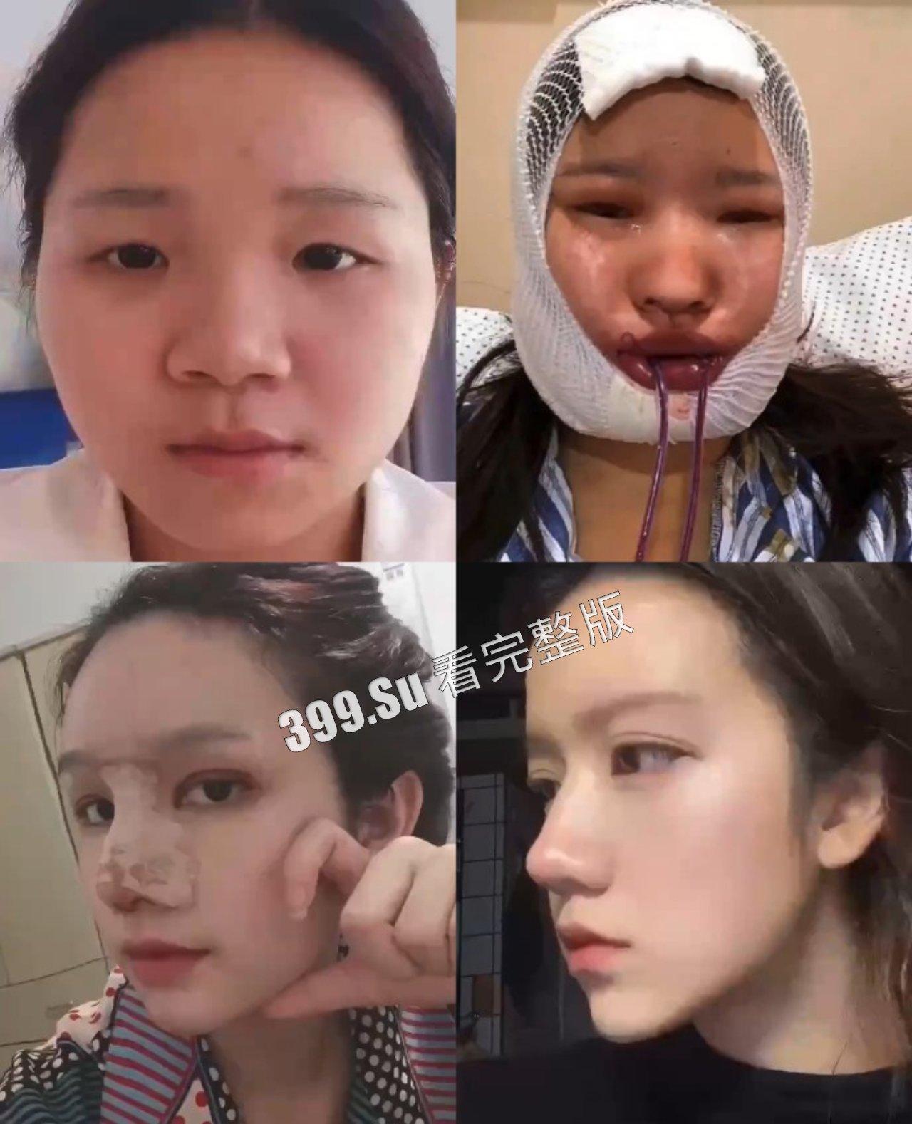 医美整形那些事儿  假的真不了 瓜友们能在生活中分辨出人造人吗？ 第1张