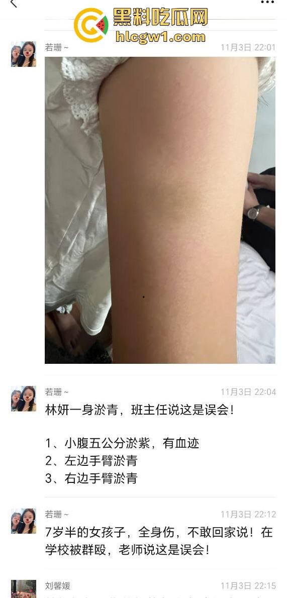 广州金隆小学曝惊天丑闻！初中学生遭体罚虐待，遍体鳞伤，家长被辱骂怒火中烧！  第2张