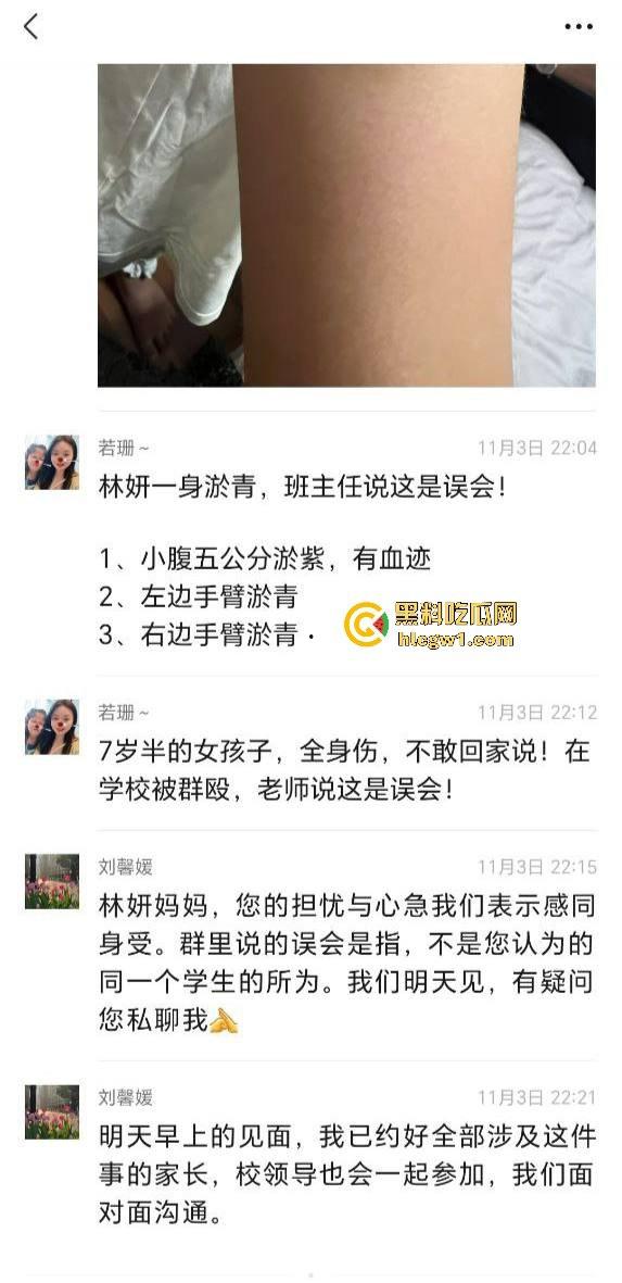 广州金隆小学曝惊天丑闻！初中学生遭体罚虐待，遍体鳞伤，家长被辱骂怒火中烧！  第3张
