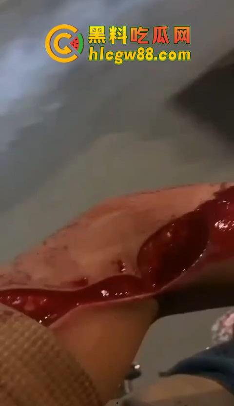 普宁盛产精神小伙，精神小伙又疯了？刀仔砍人血溅街头，这回不是社会摇，是进局子摇！  第8张