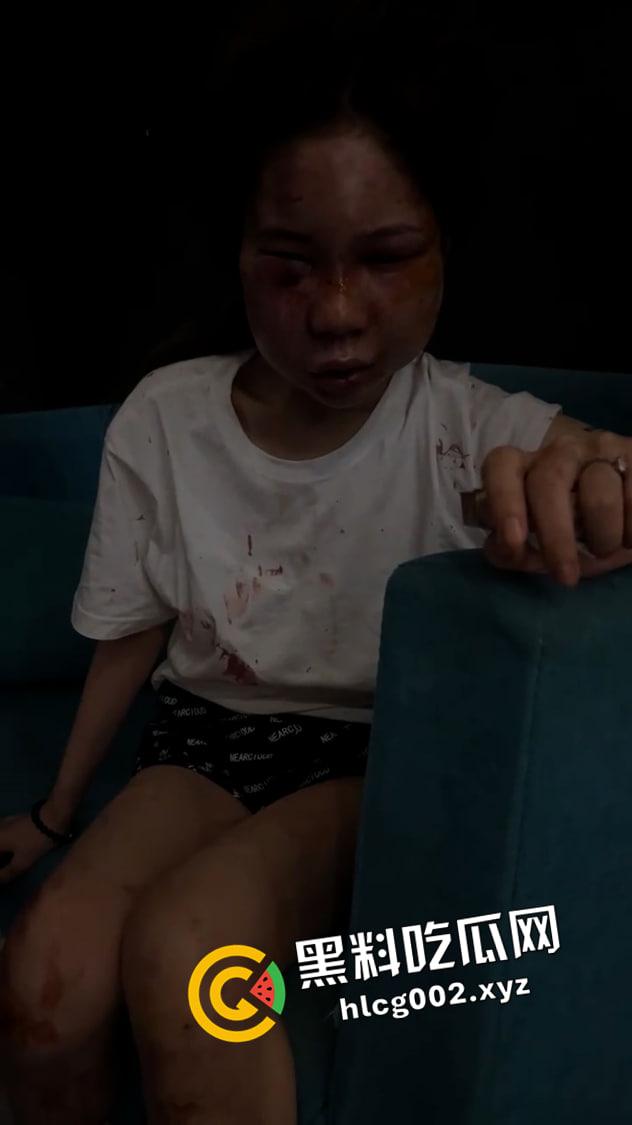 【谭竹】终被制裁打成猪头！外网悬赏金额已达六百万  现场视频流出 第3张