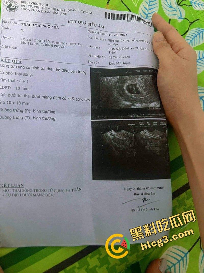 我和缅甸女友的爱情故事！这就是缅甸女的真实面孔  第1张