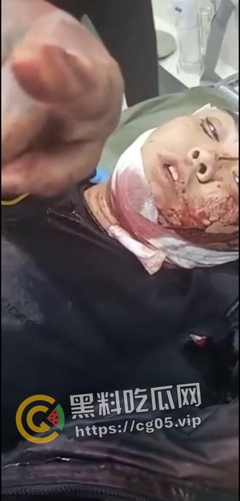 精神小伙哈尔滨斯卡拉迪厅前挑衅！上一秒嚣张至极 下一秒被打成猪头 活该  第4张