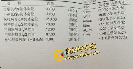 瓜友独家投稿曝光生化母体！化大附中卖淫骚鸡【余纯】600约炮单男，黑丝操逼颜射贱脸！独家流出！  第8张