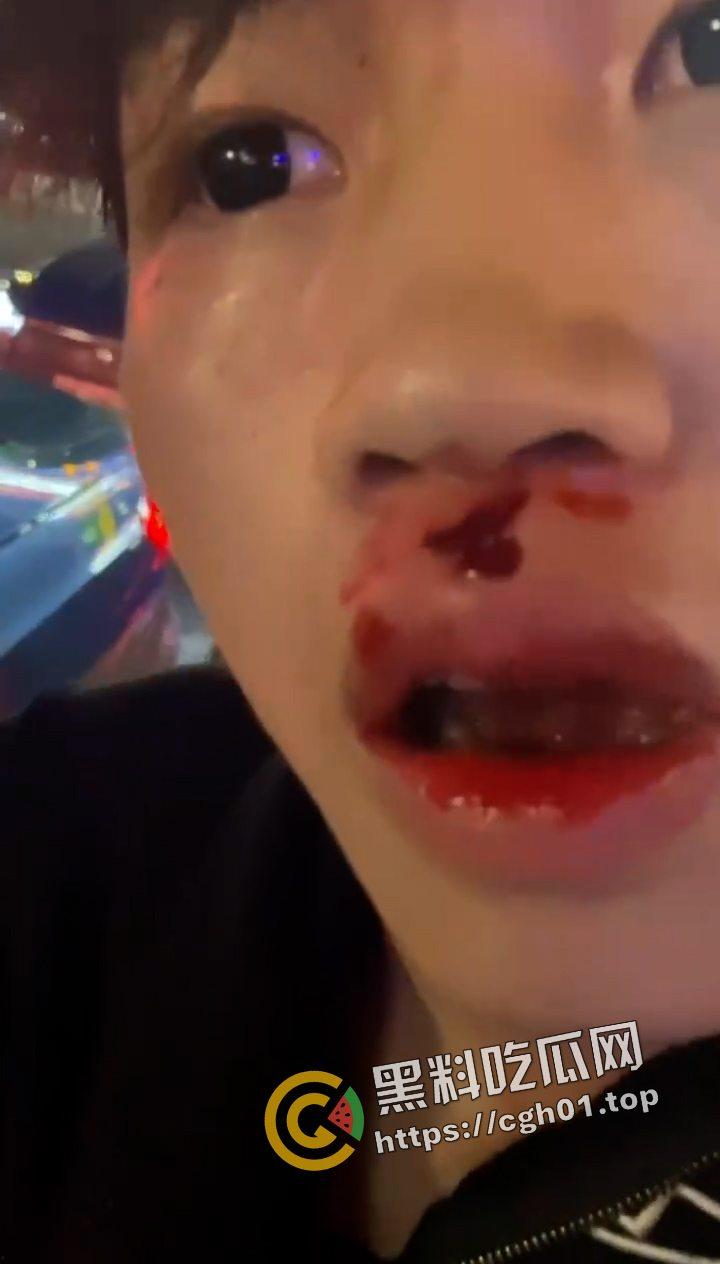 抖音网红【李金帅】街头惹事被暴打 恶人自有恶人磨 这下不嚣张了  第3张